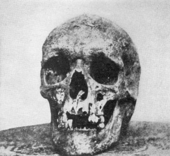 Joseph Warren's Skull in 1850s photo