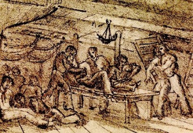 Navy Surgery in the Age of Sail